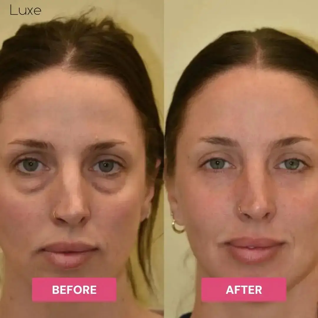 Luxe - Korean Under-Eye Balm - Image 6