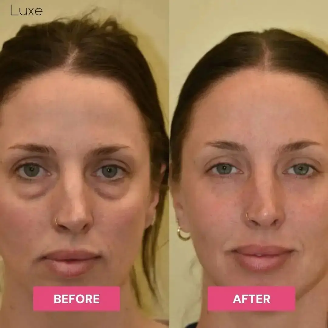 Luxe | Korean Under-Eye Balm - Image 5